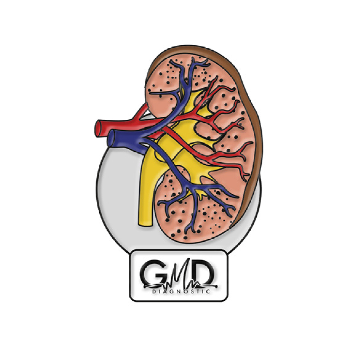 Pin gmd riñon, en colores cálidos (azul, rojo, amarillo, café y tono piel), sobre fondo blanco azulado; en una base circular; en la parte inferior, logo “GMD Diagnostic”.. Haga clic para ampliar la imagen